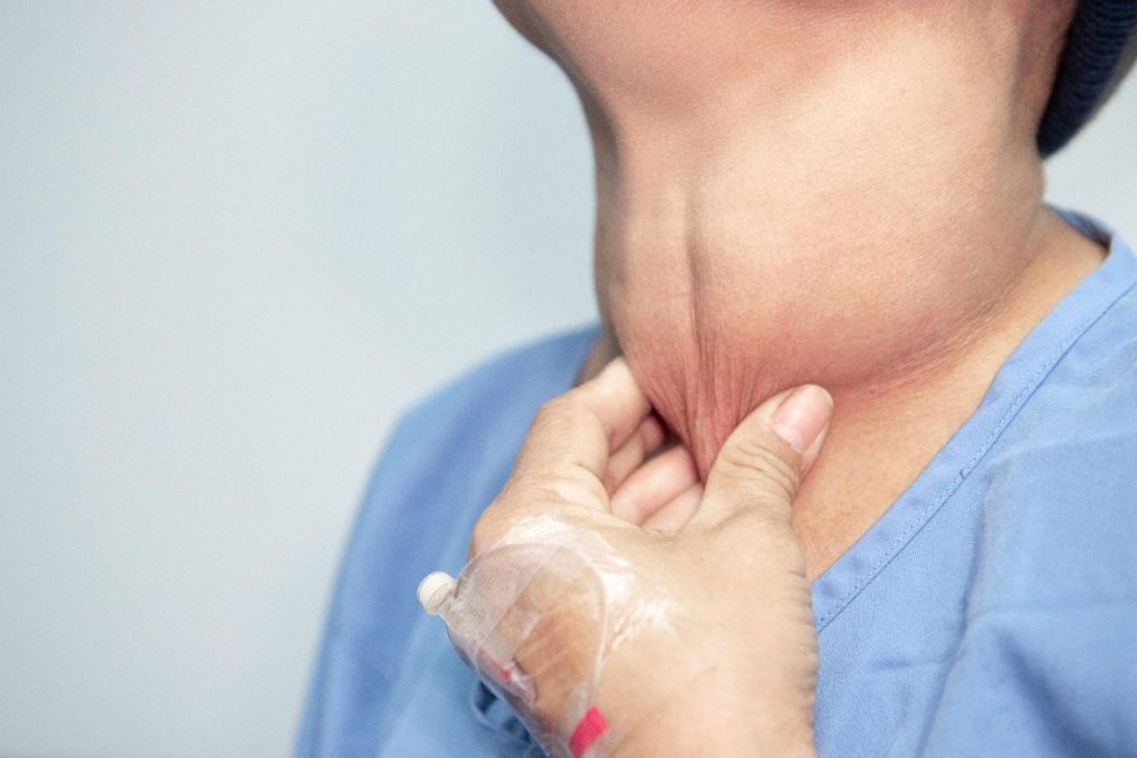 symptoms of hyperthyroidism.