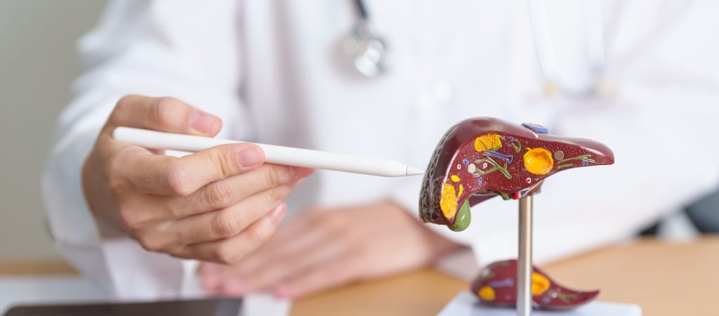 Obesity and non-alcoholic fatty liver disease